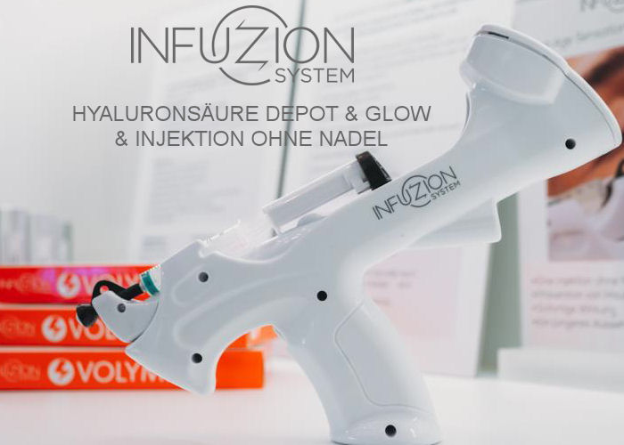 Infuzion System